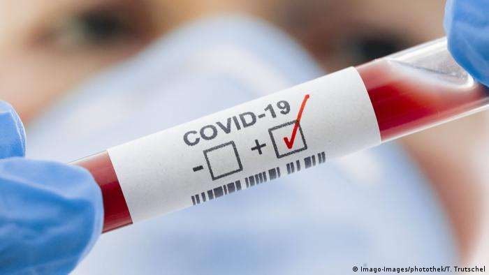 За минулу добу на Тернопільщині зафіксовано 46 нових випадків COVID-19